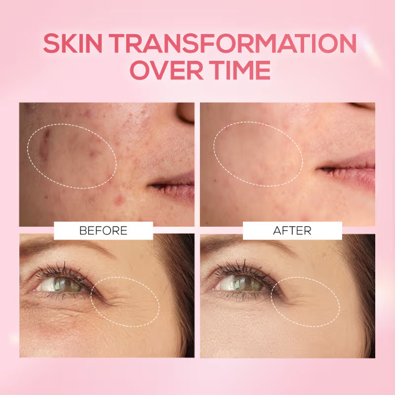 RENEE Pink Therapy PDRN Pink Peptide Serum For Radiant Skin, Hydrating, Hyaluronic Acid Infused