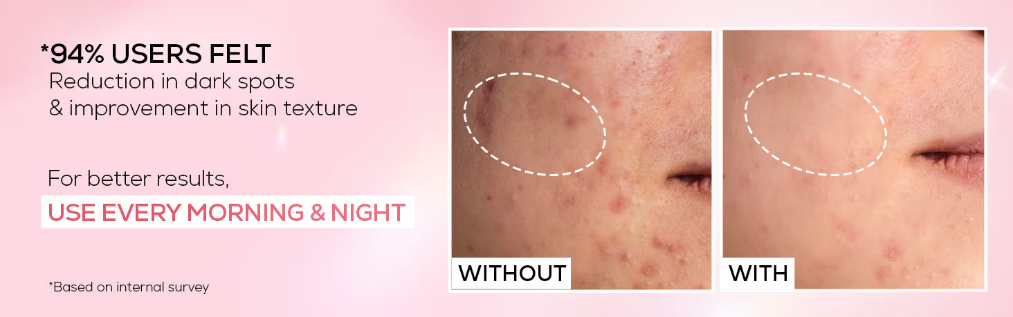 RENEE Pink Therapy PDRN Pink Peptide Serum For Radiant Skin, Hydrating, Hyaluronic Acid Infused
