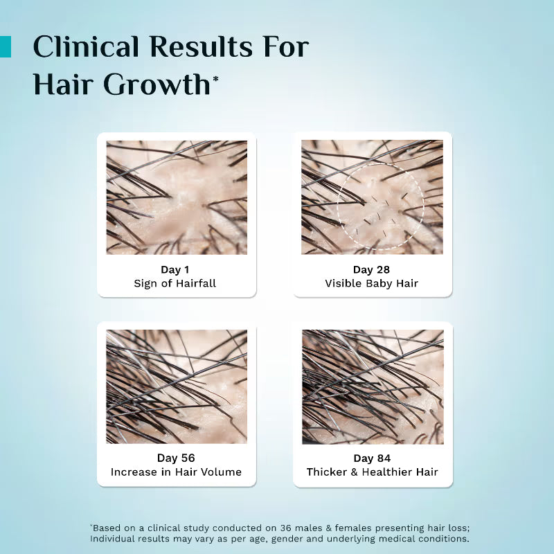 Pilgrim 3% Redensyl & 4% Anagain Advanced Hair Growth Serum